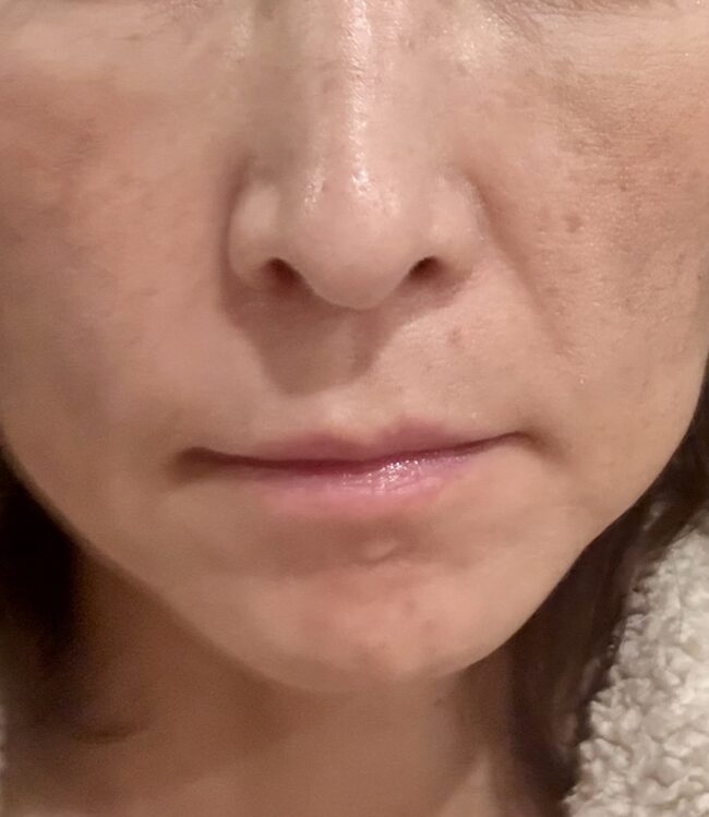 Musely Eye Serumを3か月使ってみた!目元のシワとほうれい線に効果あり!?