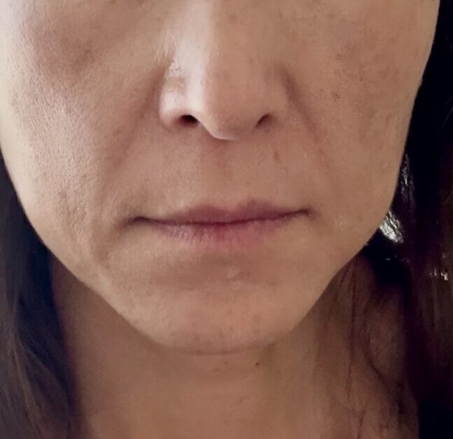 Musely Eye Serumを3か月使ってみた!目元のシワとほうれい線に効果あり!?